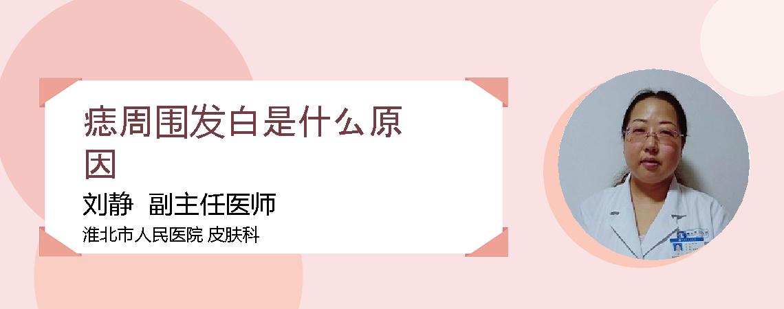 痣周围发白是什么原因