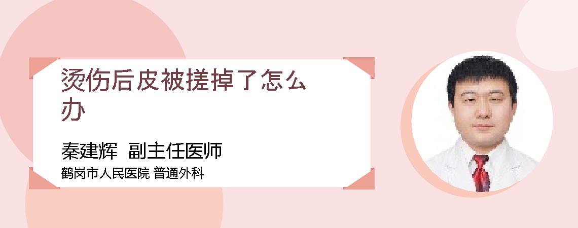 烫伤后皮被搓掉了怎么办