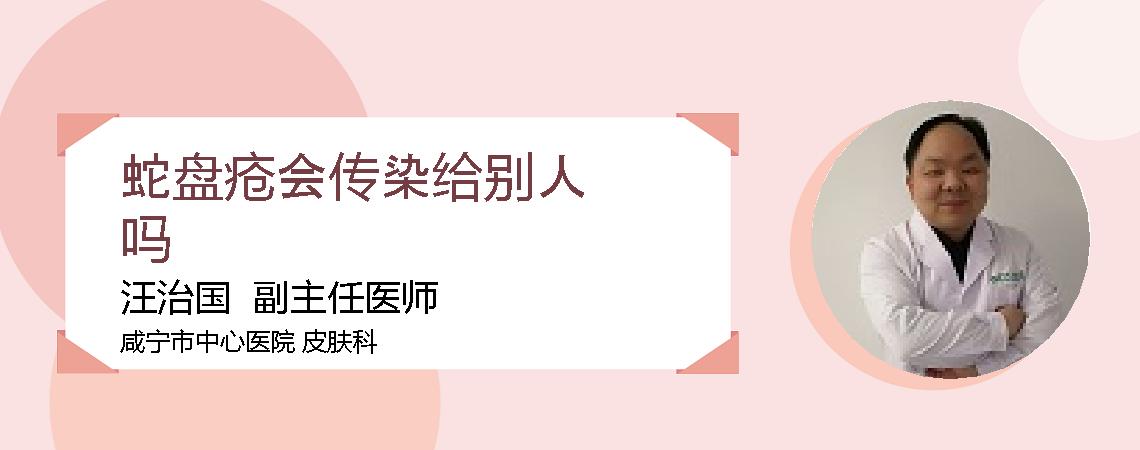 蛇盘疮会传染给别人吗