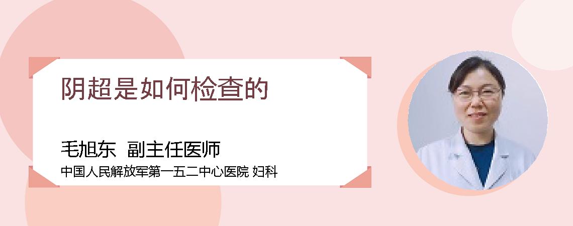 阴超是如何检查的