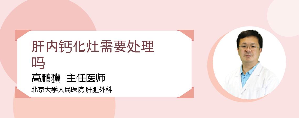 肝内钙化灶需要处理吗