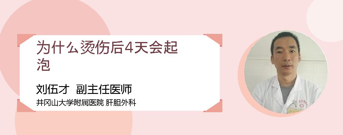 为什么烫伤后4天会起泡