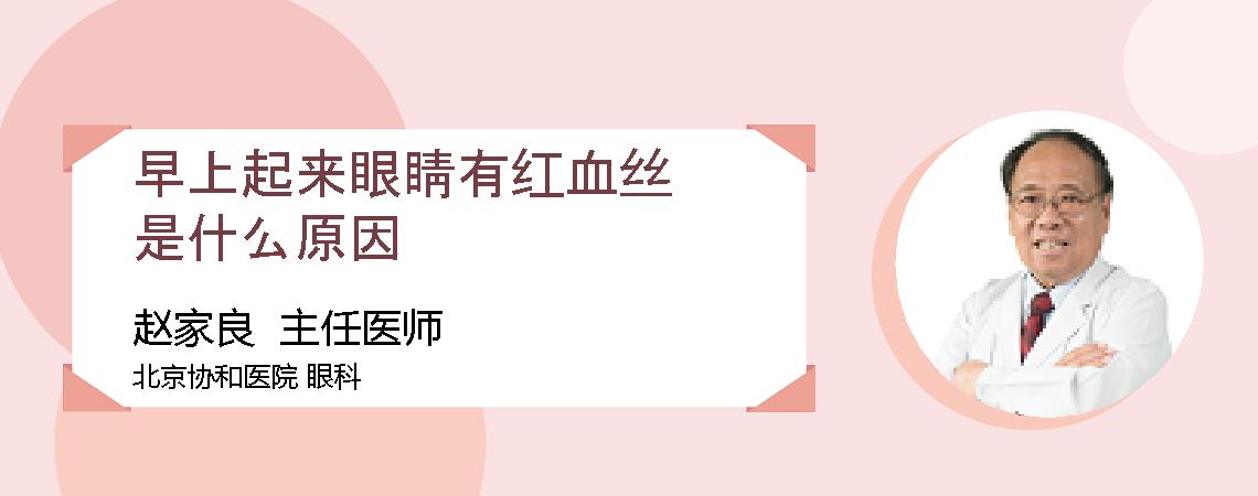 早上起来眼睛有红血丝是什么原因
