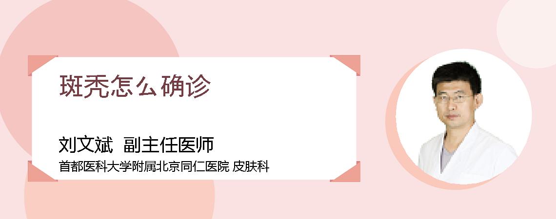 斑秃怎么确诊
