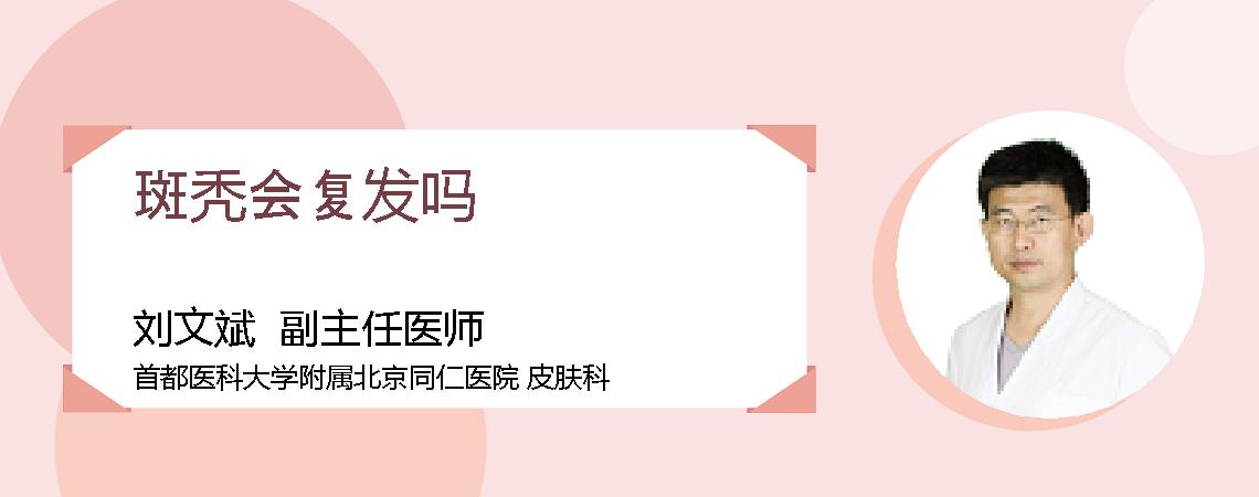 斑秃会复发吗