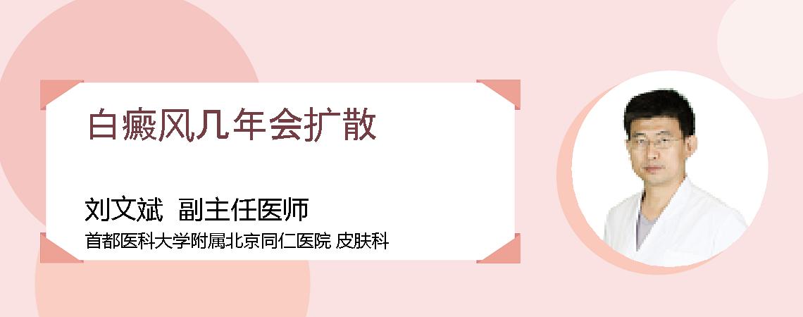 白癜风几年会扩散