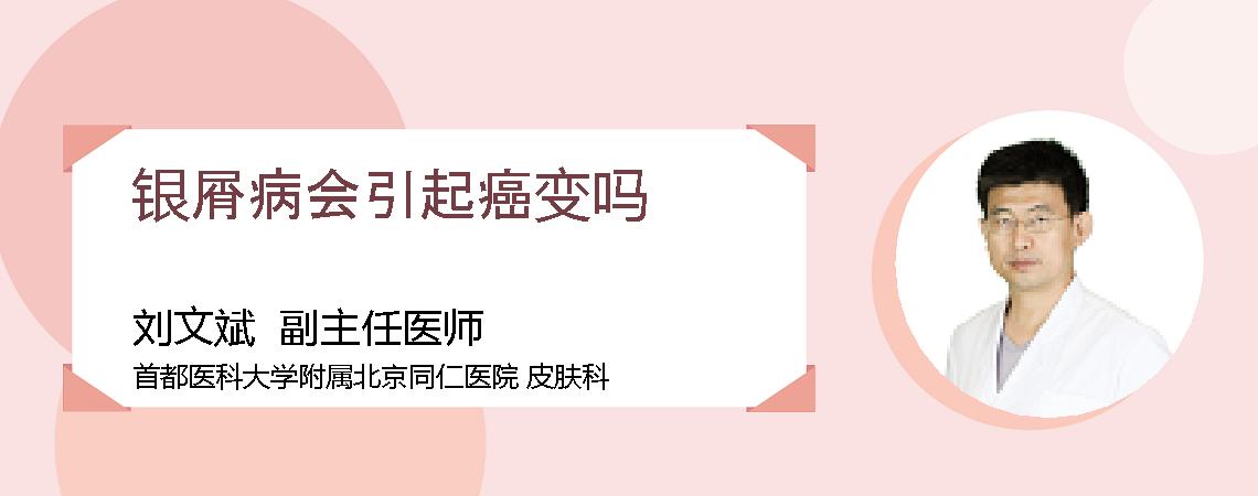 银屑病会引起癌变吗