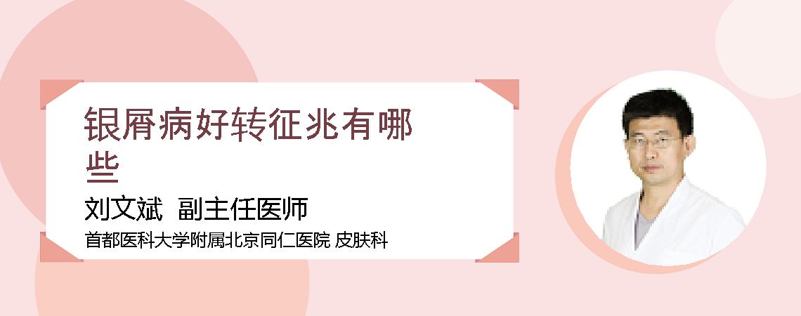 银屑病好转征兆有哪些