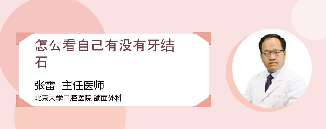 怎么看自己有没有牙结石