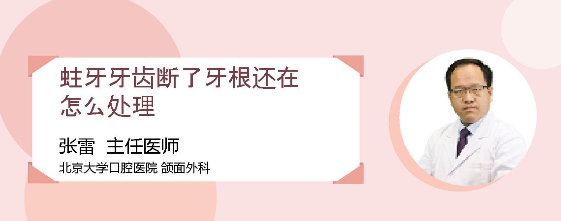蛀牙牙齿断了牙根还在怎么处理