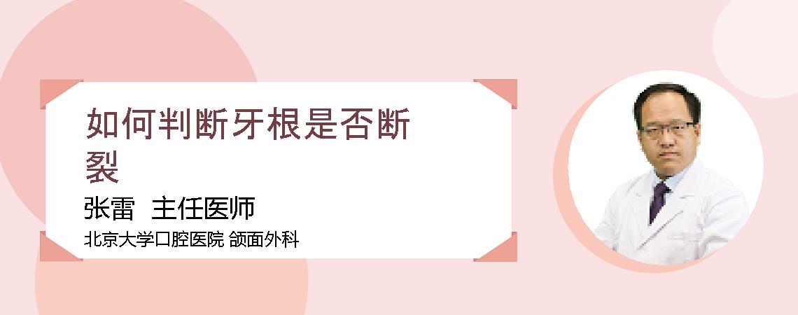 如何判断牙根是否断裂