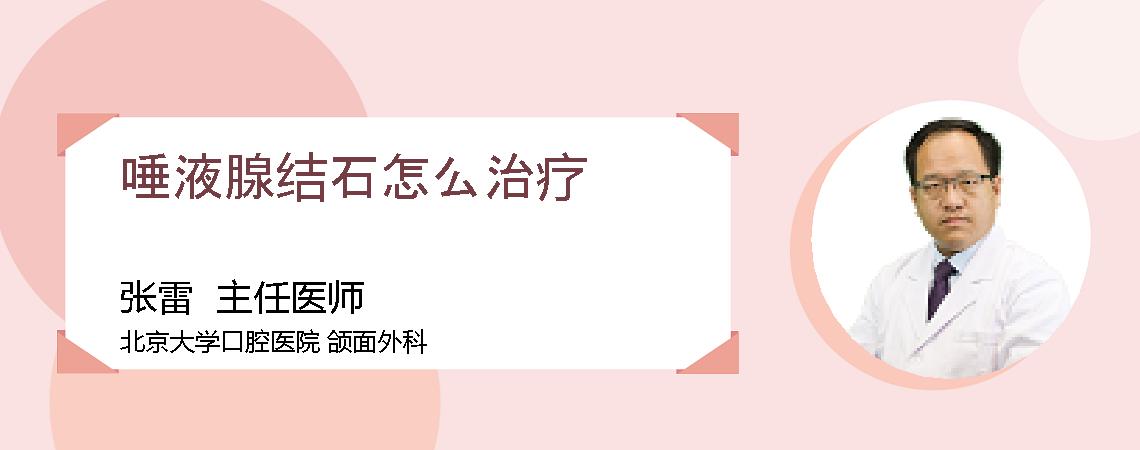 唾液腺结石怎么治疗