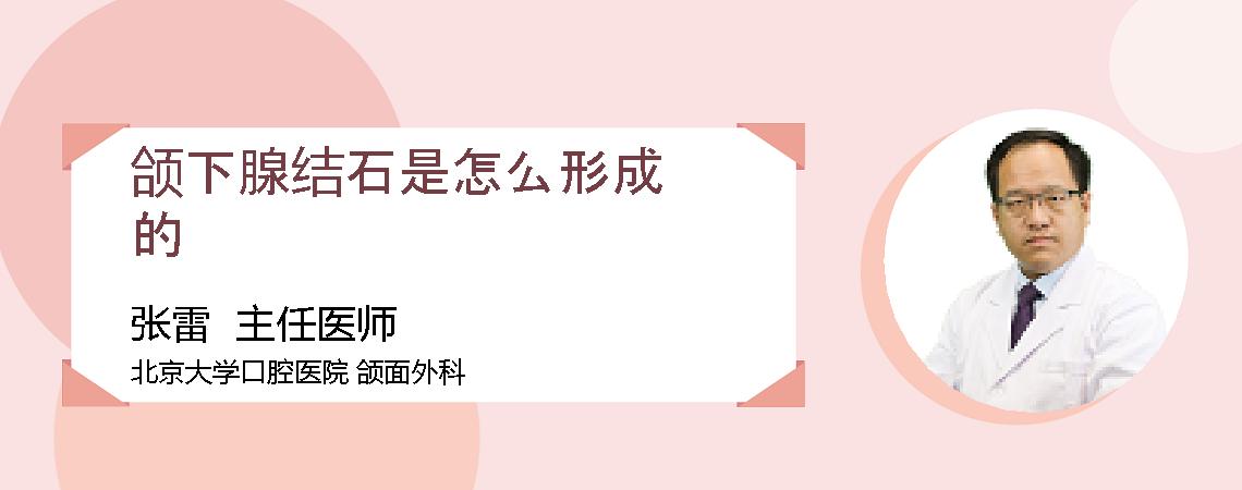 颌下腺结石是怎么形成的