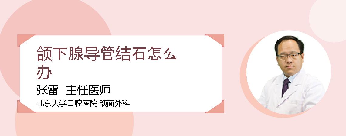 颌下腺导管结石怎么办